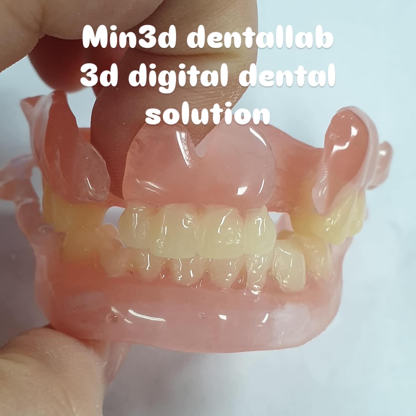 가철성 의치·RPD · 3D-flexible denture